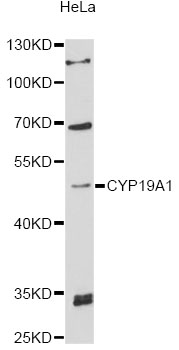 CYP19 / Aromatase Antibody - Western blot analysis of extracts of HeLa cells, using CYP19A1 antibody at 1:3000 dilution. The secondary antibody used was an HRP Goat Anti-Rabbit IgG (H+L) at 1:10000 dilution. Lysates were loaded 25ug per lane and 3% nonfat dry milk in TBST was used for blocking. An ECL Kit was used for detection and the exposure time was 60s.