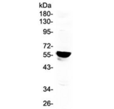 CYP19 / Aromatase Antibody - Western blot testing of human placenta lysate with CYP19A1 antibody at 0.5ug/ml. Predicted molecular weight ~58 kDa.