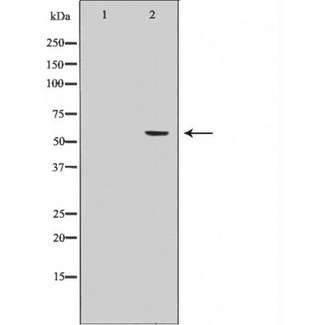 CYP19 / Aromatase Antibody - Western blot analysis of Cytochrome P450 19A1 antibody expression in human placenta tissue lysates. The lane on the left is treated with the antigen-specific peptide.