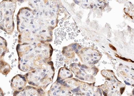 CYP19 / Aromatase Antibody - 1:100 staining human Placenta tissue by IHC-P. The tissue was formaldehyde fixed and a heat mediated antigen retrieval step in citrate buffer was performed. The tissue was then blocked and incubated with the antibody for 1.5 hours at 22°C. An HRP conjugated goat anti-rabbit antibody was used as the secondary.