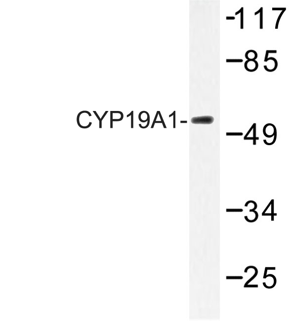 CYP19 / Aromatase Antibody - Western blot of CYP19A1 (K243) pAb in extracts from 293 cells.