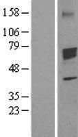 CYP19 / Aromatase Protein - Western validation with an anti-DDK antibody * L: Control HEK293 lysate R: Over-expression lysate