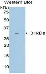 CYP1A1 Antibody - Western blot of recombinant CYP1A1.  This image was taken for the unconjugated form of this product. Other forms have not been tested.
