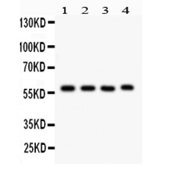 CYP1A1 Antibody - CYP1A1 antibody Western blot. All lanes: Anti CYP1A1 at 0.5 ug/ml. Lane 1: Rat Lung Tissue Lysate at 50 ug. Lane 2: Mouse Lung Tissue Lysate at 50 ug. Lane 3: Human Placenta Tissue Lysate at 50 ug. Lane 4: JURKAT Whole Cell Lysate at 40 ug. Predicted band size: 58 kD. Observed band size: 58 kD.