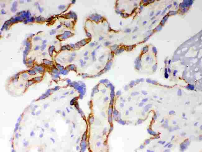 CYP1A1 Antibody - IHC analysis of CYP1A1 using anti-CYP1A1 antibody. CYP1A1 was detected in frozen section of Human Placenta Tissue. Heat mediated antigen retrieval was performed in citrate buffer (pH6, epitope retrieval solution) for 20 mins. The tissue section was blocked with 10% goat serum. The tissue section was then incubated with 1µg/ml rabbit anti-CYP1A1 Antibody overnight at 4°C. Biotinylated goat anti-rabbit IgG was used as secondary antibody and incubated for 30 minutes at 37°C. The tissue section was developed using Strepavidin-Biotin-Complex (SABC) with DAB as the chromogen.