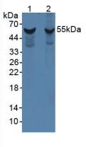 CYP1A1 Antibody - Western Blot; Sample: Lane1: Rat Liver Tissue; Lane2: Mouse Liver Tissue.