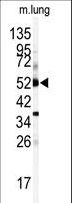 CYP1A1 Antibody - Western blot of anti-CYP1A1 Antibody in mouse lung tissue lysates (35 ug/lane). CYP1A1 (arrow) was detected using the purified antibody.