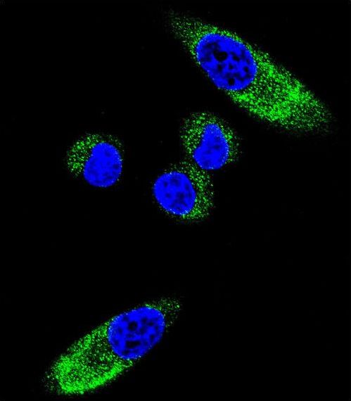CYP1A1 Antibody - Confocal immunofluorescence of CYP1A1 Antibody with MDA-MB231 cell followed by Alexa Fluor 488-conjugated goat anti-rabbit lgG (green). DAPI was used to stain the cell nuclear (blue).