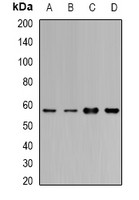 CYP1A1 Antibody - Western blot analysis of Cytochrome P450 1A1 expression in MCF7 (A); BT474 (B); mouse lung (C); mouse liver (D) whole cell lysates.