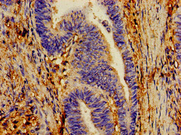 CYP1A1 Antibody - Immunohistochemistry image of paraffin-embedded human lung tissue at a dilution of 1:100