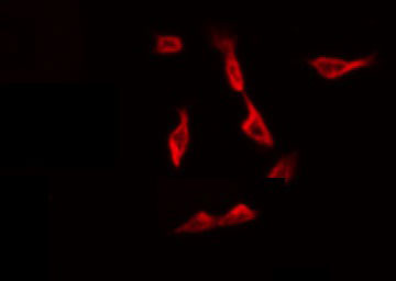 CYP1A1 Antibody - Staining HeLa cells by IF/ICC. The samples were fixed with PFA and permeabilized in 0.1% Triton X-100, then blocked in 10% serum for 45 min at 25°C. The primary antibody was diluted at 1:200 and incubated with the sample for 1 hour at 37°C. An Alexa Fluor 594 conjugated goat anti-rabbit IgG (H+L) Ab, diluted at 1/600, was used as the secondary antibody.