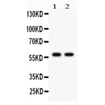 CYP1A2 Antibody - CYP1A2 antibody Western blot. All lanes: Anti CYP1A2 at 0.5 ug/ml. Lane 1: Rat Liver Tissue Lysate at 50 ug. Lane 2: Mouse Liver Tissue Lysate at 50 ug. Predicted band size: 58 kD. Observed band size: 58 kD.