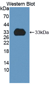 CYP1A2 Antibody - Western blot of CYP1A2 antibody.