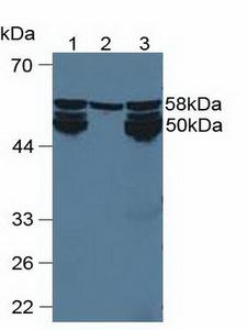 CYP1A2 Antibody - Western Blot; Sample: Lane1: Rat Liver Tissue; Lane2: Human Hela Cells; Lane3: Mouse Liver Tissue.