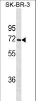 CYP1A2 Antibody - CYP1A2 Antibody western blot of SK-BR-3 cell line lysates (35 ug/lane). The CYP1A2 antibody detected the CYP1A2 protein (arrow).