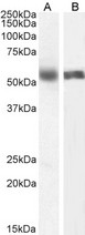 CYP1A2 Antibody - Goat Anti-Cytochrome P450 1A2 (mouse) Antibody (0.5µg/ml) staining of Human Liver (A) and (1ug/ml) Lung (B) lysate (35µg protein in RIPA buffer). Primary incubation was 1 hour. Detected by chemiluminescencence.