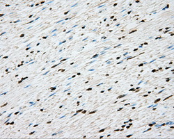 CYP1A2 Antibody - IHC of paraffin-embedded colon tissue using anti-CYP1A2 mouse monoclonal antibody. (Dilution 1:50).