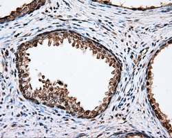 CYP1A2 Antibody - IHC of paraffin-embedded prostate tissue using anti-CYP1A2 mouse monoclonal antibody. (Dilution 1:50).