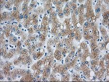 CYP1A2 Antibody - Immunohistochemical staining of paraffin-embedded liver tissue using anti-CYP1A2 mouse monoclonal antibody. (Dilution 1:50).