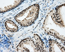 CYP1A2 Antibody - Immunohistochemical staining of paraffin-embedded prostate tissue using anti-CYP1A2 mouse monoclonal antibody. (Dilution 1:50).