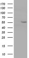 CYP1A2 Antibody - HEK293T cells were transfected with the pCMV6-ENTRY control (Left lane) or pCMV6-ENTRY CYP1A2 (Right lane) cDNA for 48 hrs and lysed. Equivalent amounts of cell lysates (5 ug per lane) were separated by SDS-PAGE and immunoblotted with anti-CYP1A2.