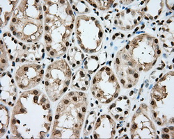 CYP1A2 Antibody - IHC of paraffin-embedded Kidney tissue using anti-CYP1A2 mouse monoclonal antibody. (Dilution 1:50).