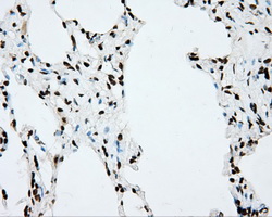 CYP1A2 Antibody - IHC of paraffin-embedded lung tissue using anti-CYP1A2 mouse monoclonal antibody. (Dilution 1:50).