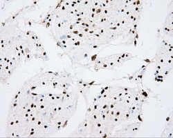 CYP1A2 Antibody - IHC of paraffin-embedded bladder tissue using anti-CYP1A2 mouse monoclonal antibody. (Dilution 1:50).