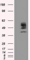 CYP1A2 Antibody - HEK293T cells were transfected with the pCMV6-ENTRY control (Left lane) or pCMV6-ENTRY CYP1A2 (Right lane) cDNA for 48 hrs and lysed. Equivalent amounts of cell lysates (5 ug per lane) were separated by SDS-PAGE and immunoblotted with anti-CYP1A2.