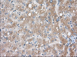 CYP1A2 Antibody - IHC of paraffin-embedded Human liver tissue using anti-CYP1A2 mouse monoclonal antibody. (Dilution 1:50).