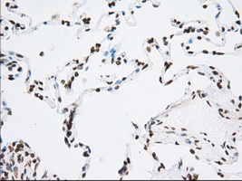 CYP1A2 Antibody - IHC of paraffin-embedded Human lung tissue using anti-CYP1A2 mouse monoclonal antibody. (Dilution 1:50).