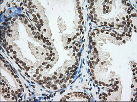 CYP1A2 Antibody - IHC of paraffin-embedded Human prostate tissue using anti-CYP1A2 mouse monoclonal antibody. (Dilution 1:50).