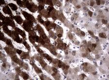 CYP1A2 Antibody - Immunohistochemical staining of paraffin-embedded Human embryonic liver tissue using anti-CYP1A2 mouse monoclonal antibody.  heat-induced epitope retrieval by 10mM citric buffer, pH6.0, 120C for 3min)