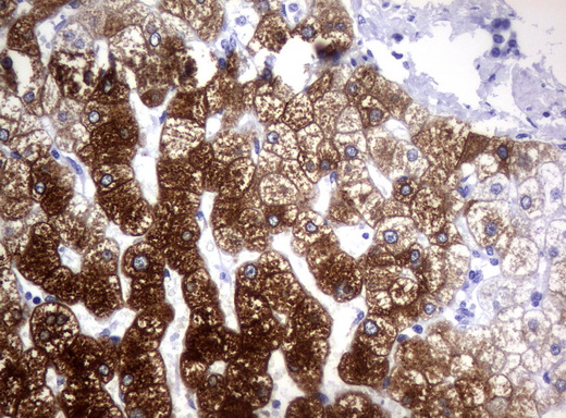 CYP1A2 Antibody - Immunohistochemical staining of paraffin-embedded Human liver tissue using anti-CYP1A2 mouse monoclonal antibody.  heat-induced epitope retrieval by 10mM citric buffer, pH6.0, 120C for 3min)