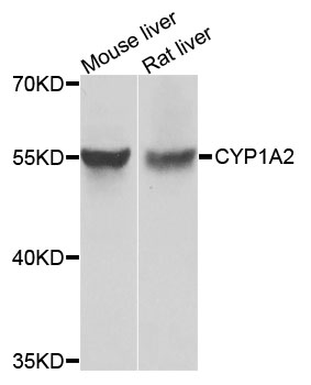 CYP1A2 Antibody - Western blot analysis of extracts of various cell lines, using CYP1A2 antibody at 1:1000 dilution. The secondary antibody used was an HRP Goat Anti-Rabbit IgG (H+L) at 1:10000 dilution. Lysates were loaded 25ug per lane and 3% nonfat dry milk in TBST was used for blocking. An ECL Kit was used for detection and the exposure time was 5s.