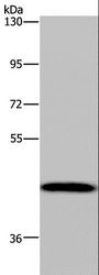 CYP1A2 Antibody - Western blot analysis of Human hepatocellular carcinoma tissue, using CYP1A2 Polyclonal Antibody at dilution of 1:440.