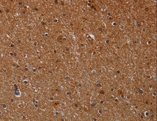 CYP1A2 Antibody - Immunohistochemistry of paraffin-embedded Human brain using CYP1A2 Polyclonal Antibody at dilution of 1:40.