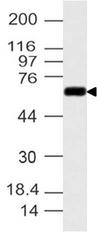 CYP1B1 Antibody - Fig-1: Western blot analysis of CYP1B1. Anti-CYP1B1 antibody was used at 4 µg/ml on A549 lysate.