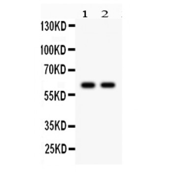CYP1B1 Antibody - CYP1B1 antibody Western blot. All lanes: Anti CYP1B1 at 0.5 ug/ml. Lane 1: Rat Kidney Tissue Lysate at 50 ug. Lane 2: MCF-7 Whole Cell Lysate at 40 ug. Predicted band size: 61 kD. Observed band size: 61 kD.