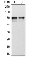 CYP1B1 Antibody - Western blot analysis of Cytochrome P450 1B1 expression in human tonsil (A); human liver (B) whole cell lysates.