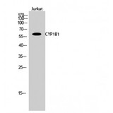CYP1B1 Antibody - Western blot of CYP1B1 antibody