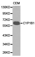 CYP1B1 Antibody - Western blot of extracts of CEM cell lines, using CYP1B1 antibody.