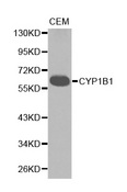 CYP1B1 Antibody - Western blot analysis of extracts of CEM cell lines, using CYP1B1 antibody.