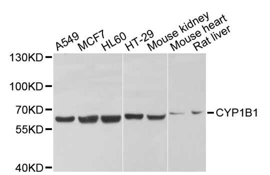 CYP1B1 Antibody - Western blot analysis of extracts of various cell lines, using CYP1B1 antibody at 1:1000 dilution. The secondary antibody used was an HRP Goat Anti-Rabbit IgG (H+L) at 1:10000 dilution. Lysates were loaded 25ug per lane and 3% nonfat dry milk in TBST was used for blocking. An ECL Kit was used for detection and the exposure time was 5s.