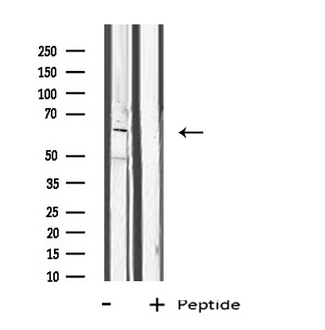 CYP1B1 Antibody - Western blot analysis of extracts of Jurkat cells using CP1B1 antibody.