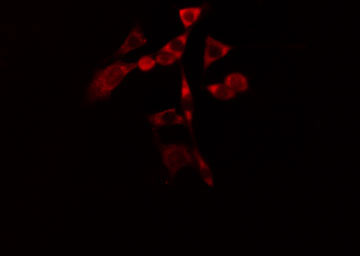 CYP1B1 Antibody - Staining HeLa cells by IF/ICC. The samples were fixed with PFA and permeabilized in 0.1% Triton X-100, then blocked in 10% serum for 45 min at 25°C. The primary antibody was diluted at 1:200 and incubated with the sample for 1 hour at 37°C. An Alexa Fluor 594 conjugated goat anti-rabbit IgG (H+L) antibody, diluted at 1/600, was used as secondary antibody.