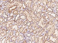 CYP1B1 Antibody - Immunochemical staining of human CYP1B1 in human kidney with rabbit polyclonal antibody at 1:100 dilution, formalin-fixed paraffin embedded sections.
