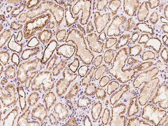 CYP1B1 Antibody - Immunochemical staining of human CYP1B1 in human kidney with rabbit polyclonal antibody at 1:100 dilution, formalin-fixed paraffin embedded sections.