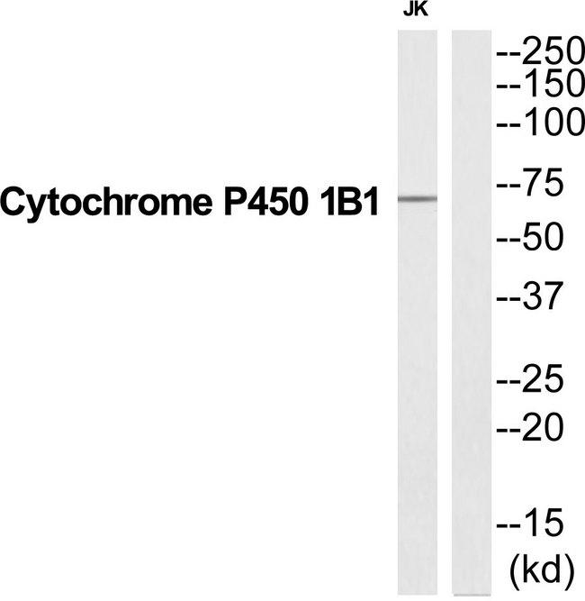 CYP1B1 Antibody - Western blot analysis of extracts from Jurkat cells, using CP1B1 antibody.