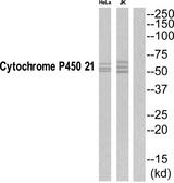CYP21 / Steroid 21-Hydroxylase Antibody - Western blot analysis of extracts from Jurkat/HeLa cells, using CYP21A2 antibody.
